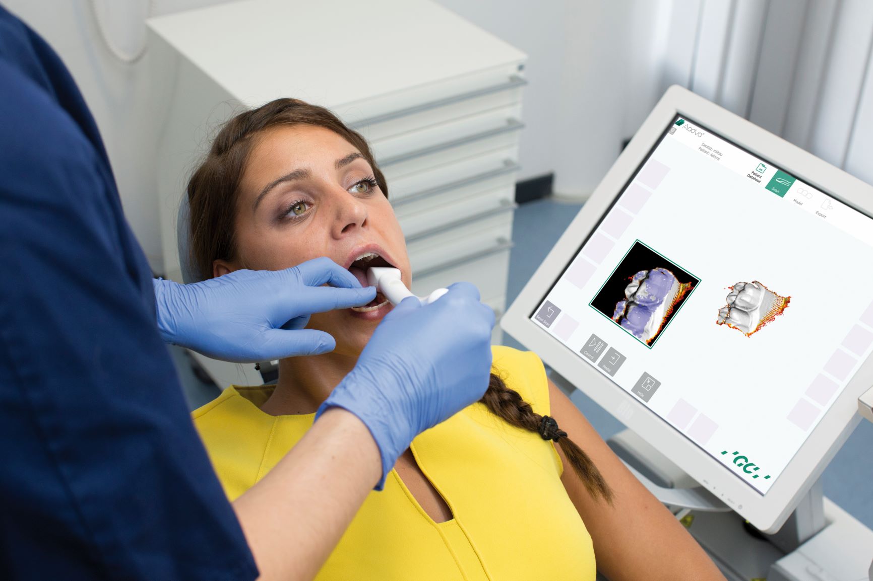 3D Dentalscanner berührungslose Zahnvermessung mittels optischen 3D Scan-Sensor  - AIT Austrian Institute Of Technology